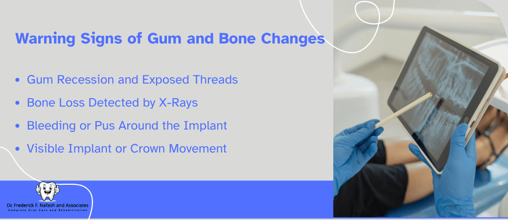 Gum and Bone Changes to Watch For
