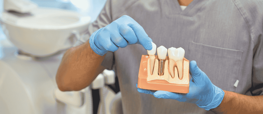 delayed dental implants